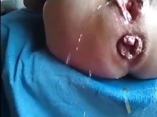 Prolapsed anus grandma masturbating till squirting