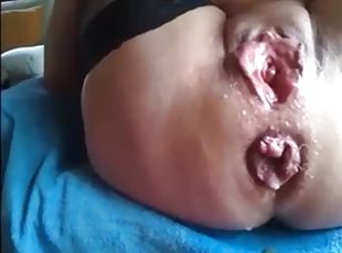 Prolapsed anus granny masturbation and squirting